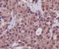 Anti-Hsp70 HSPA1A Rabbit Monoclonal Antibody